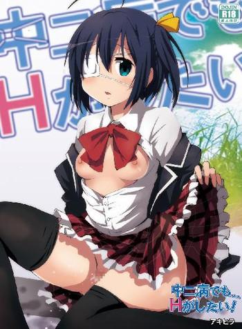 chuunibyou demo ecchi ga shitai cover